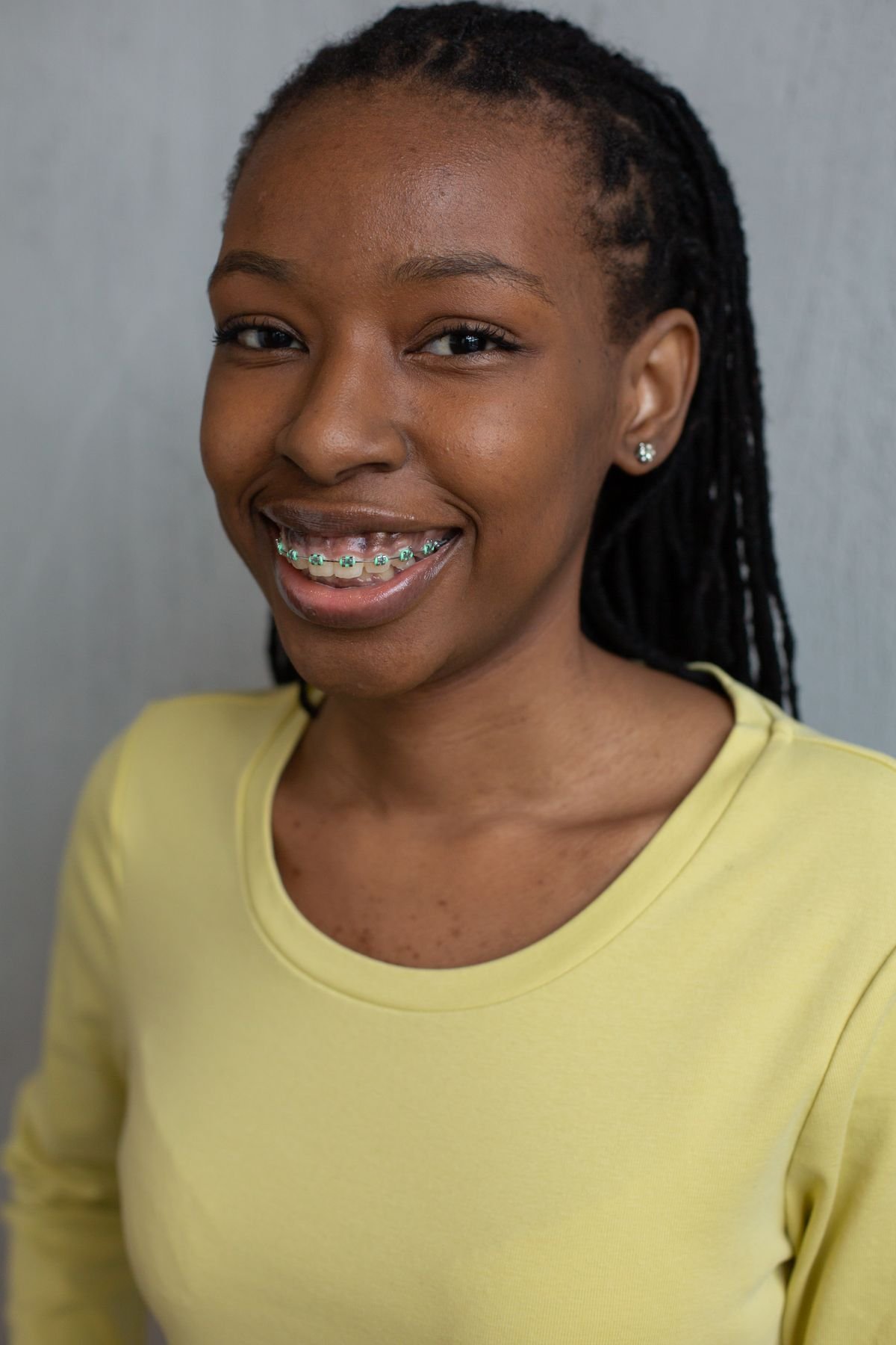 Fixed Braces